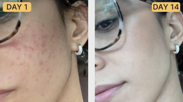Customer results 1