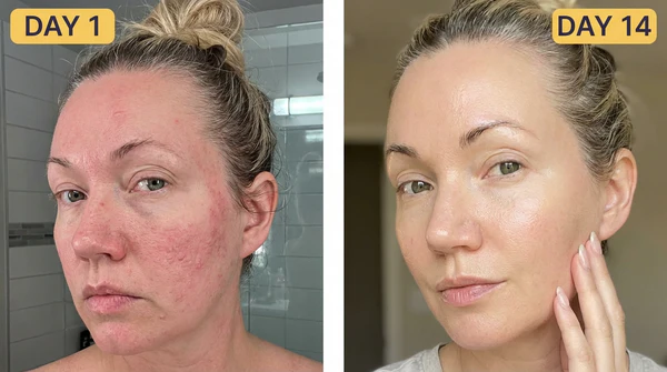Customer results 2
